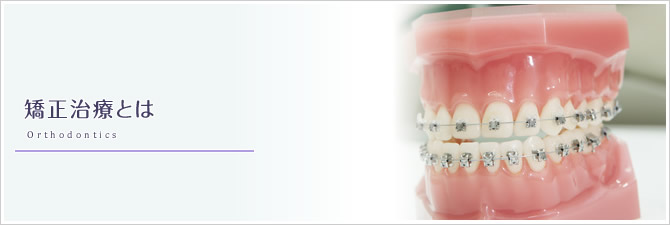 矯正治療とは Orthodontics